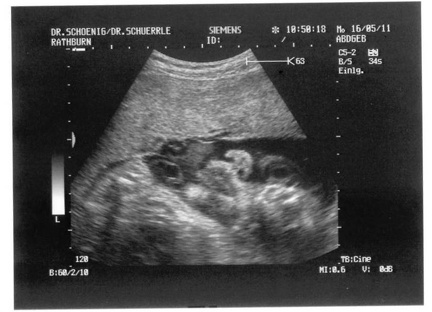 Ultrasound 16May2011b